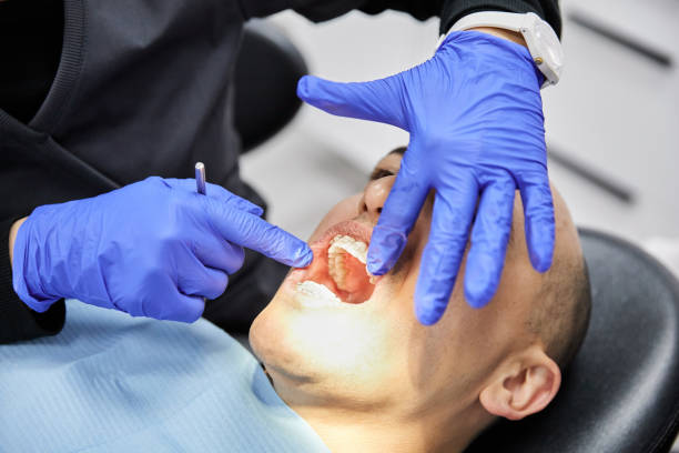Best Emergency Wisdom Teeth Removal in Honey Grove, TX