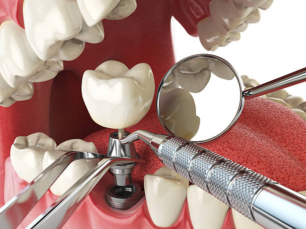 Best Emergency Dental Care for Broken or Chipped Teeth in Honey Grove, TX